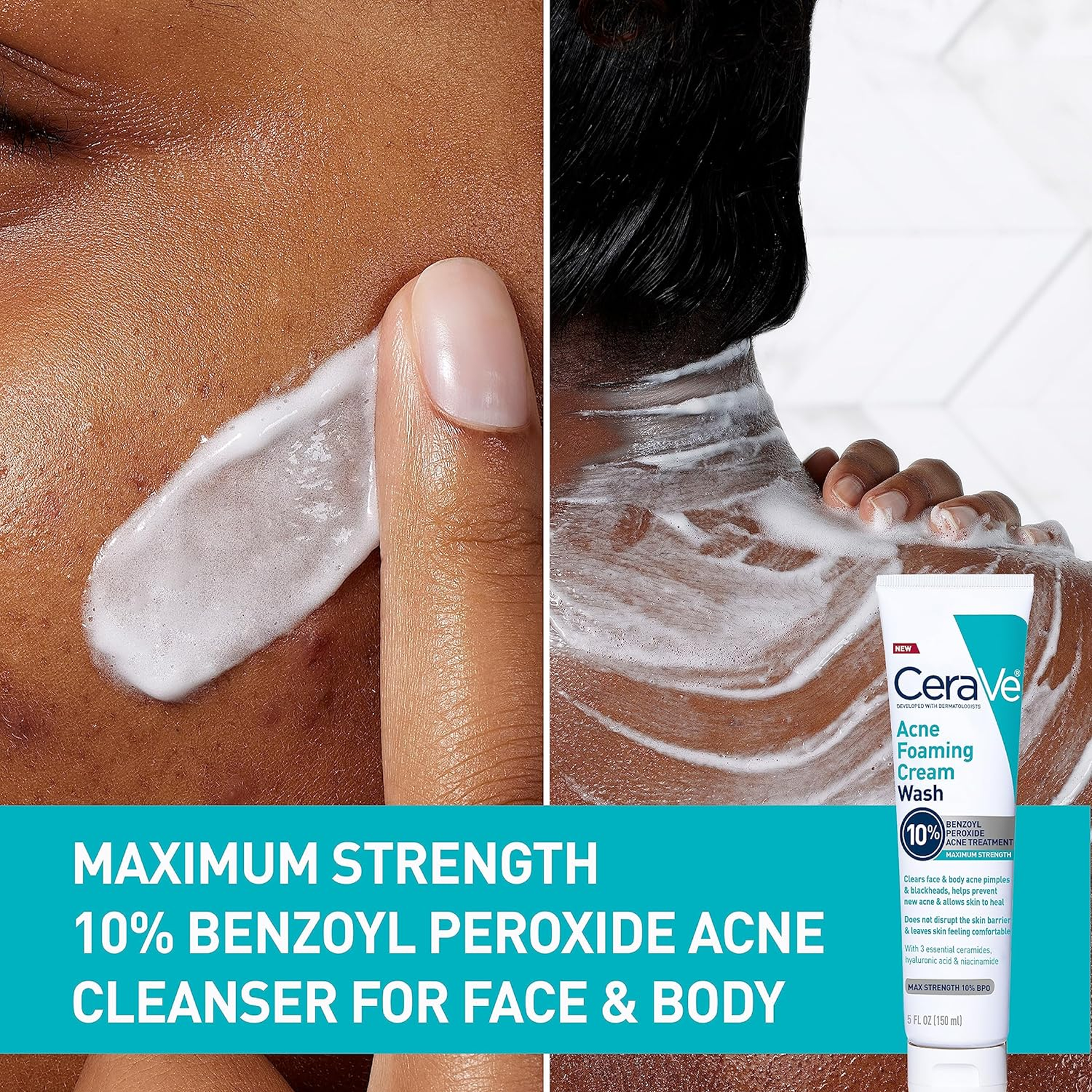 Advantages of CeraVe Acne Foaming Cream Wash 