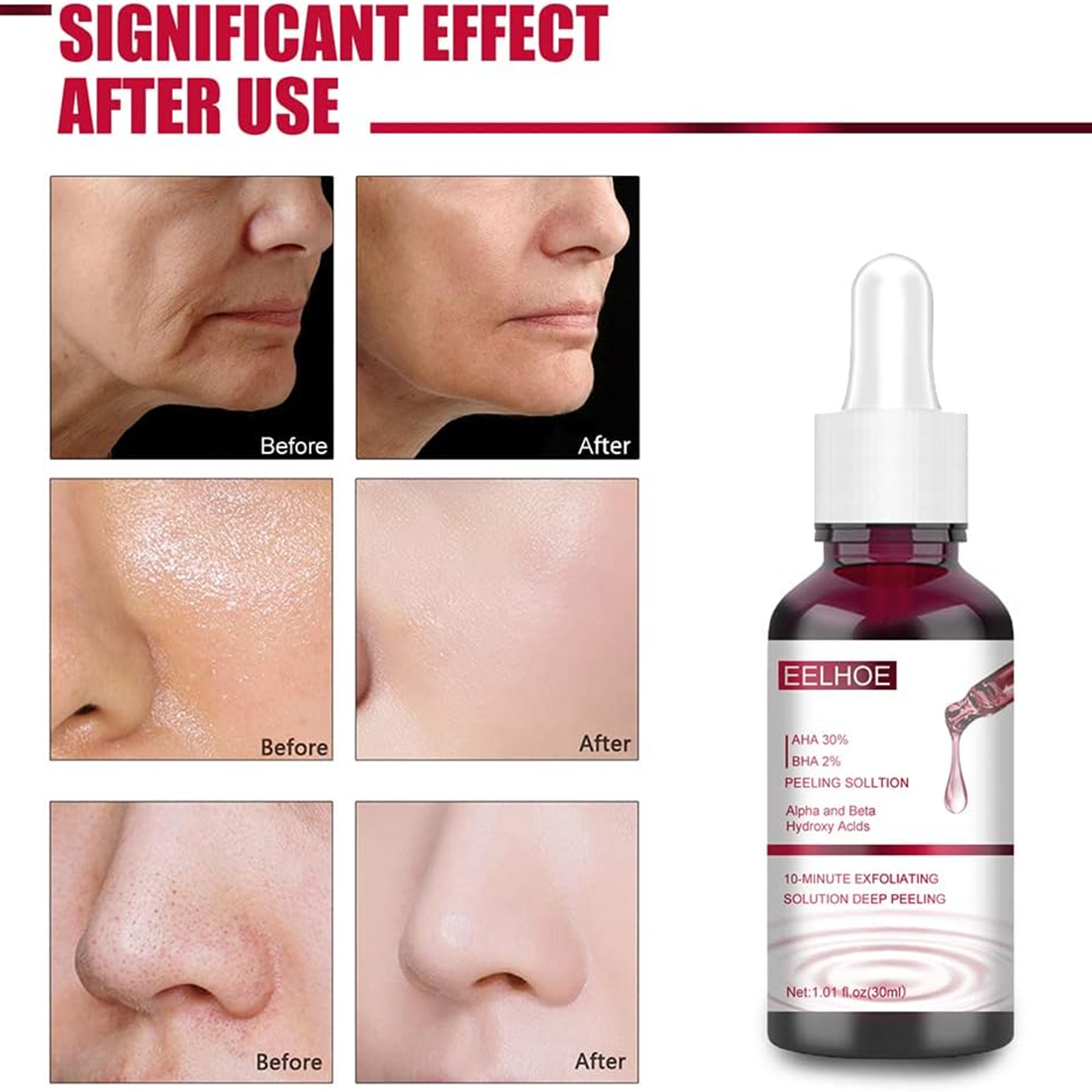 Eelhoe  AHA 30% + BHA 2% Peeling Solution - 30ml
