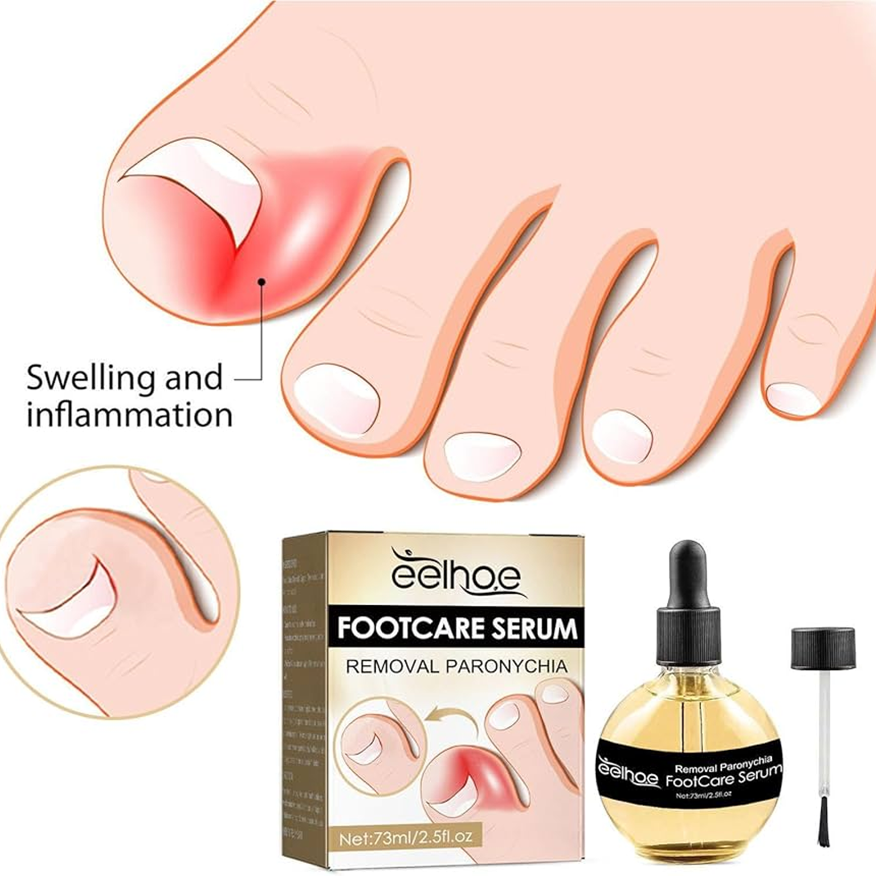 Eelhoe Footcare Serum Removal Paronychia - 73ml