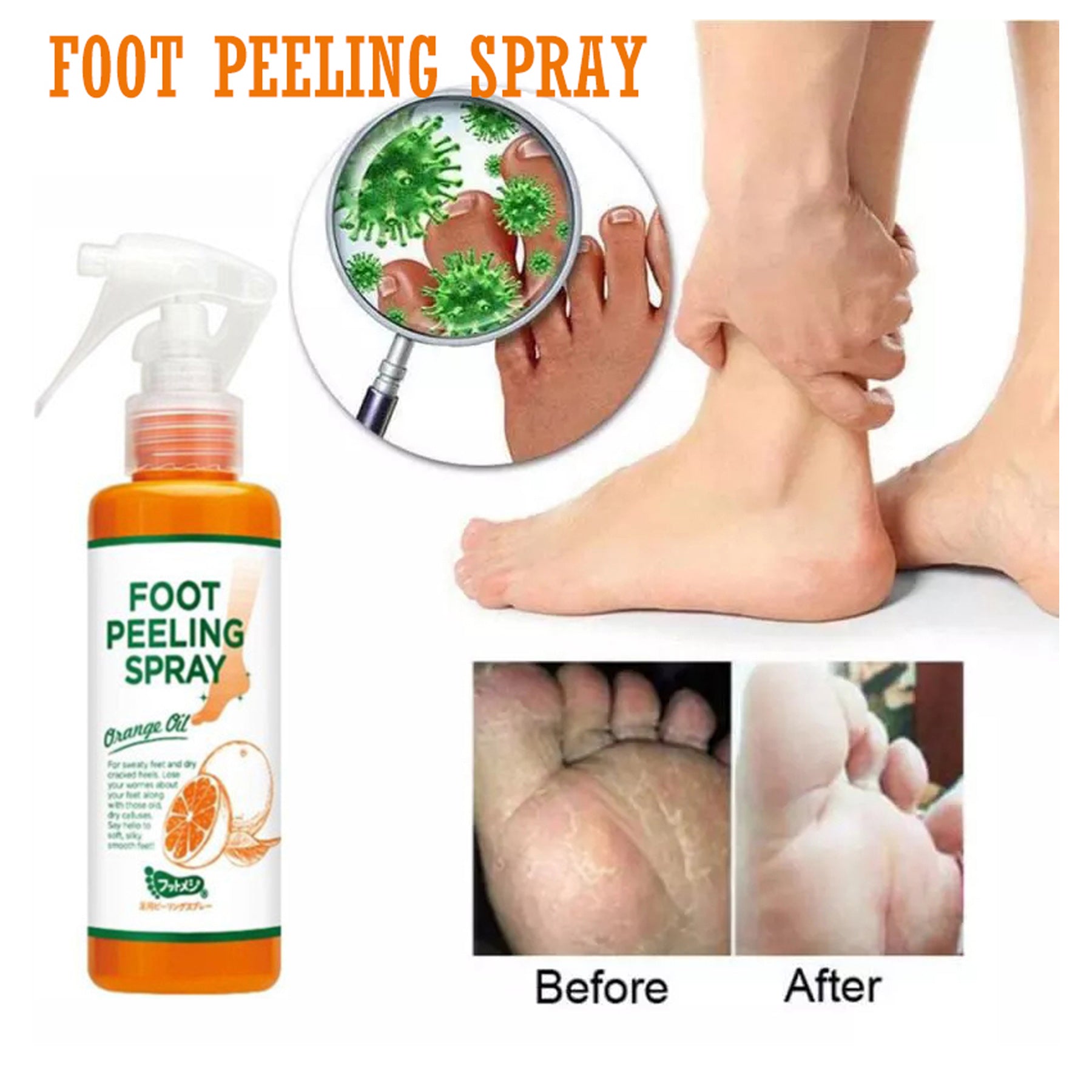 Foot Peeling Spray - 110ml