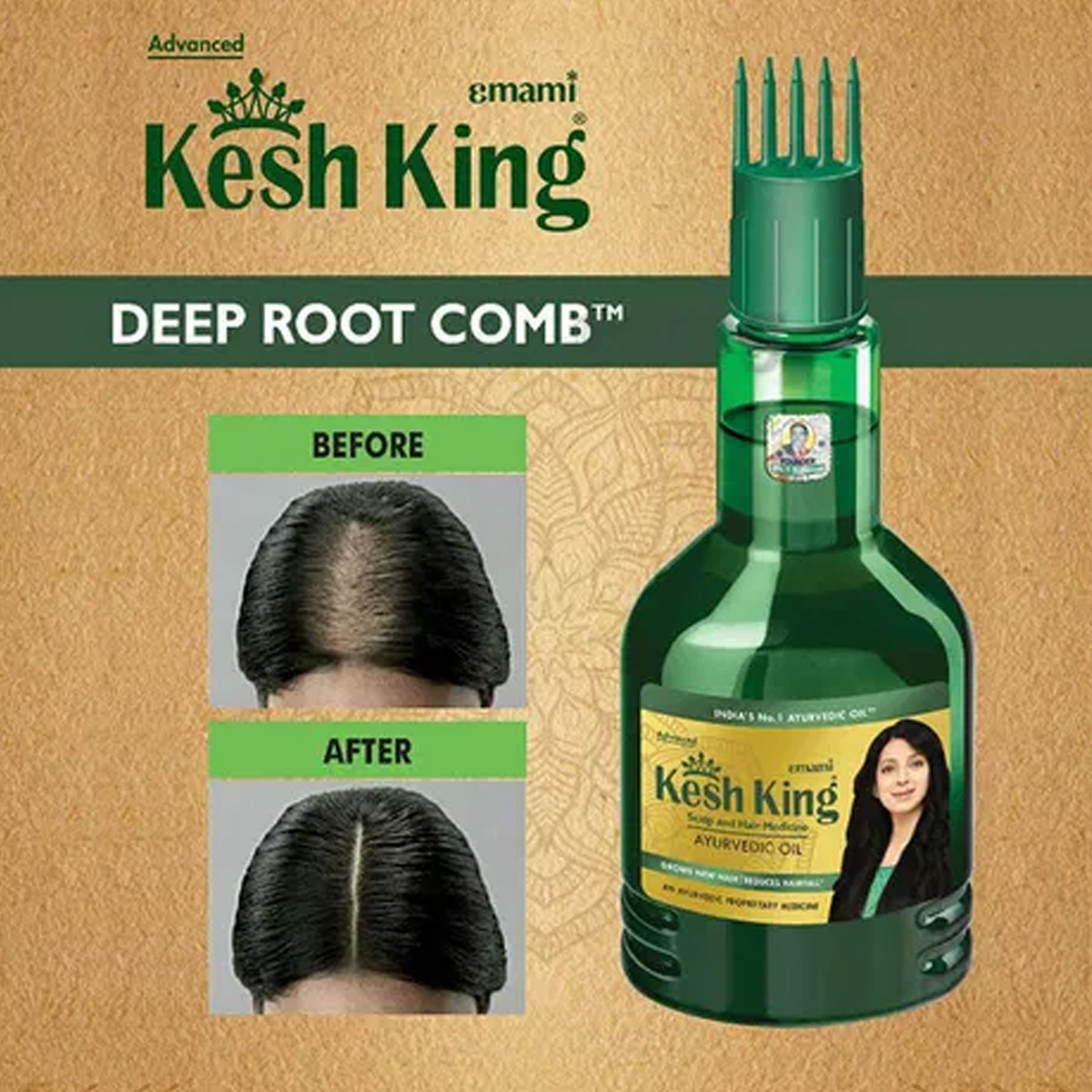 Kesh King Herbal Ayuvedic Hair Oil For Hair Growth