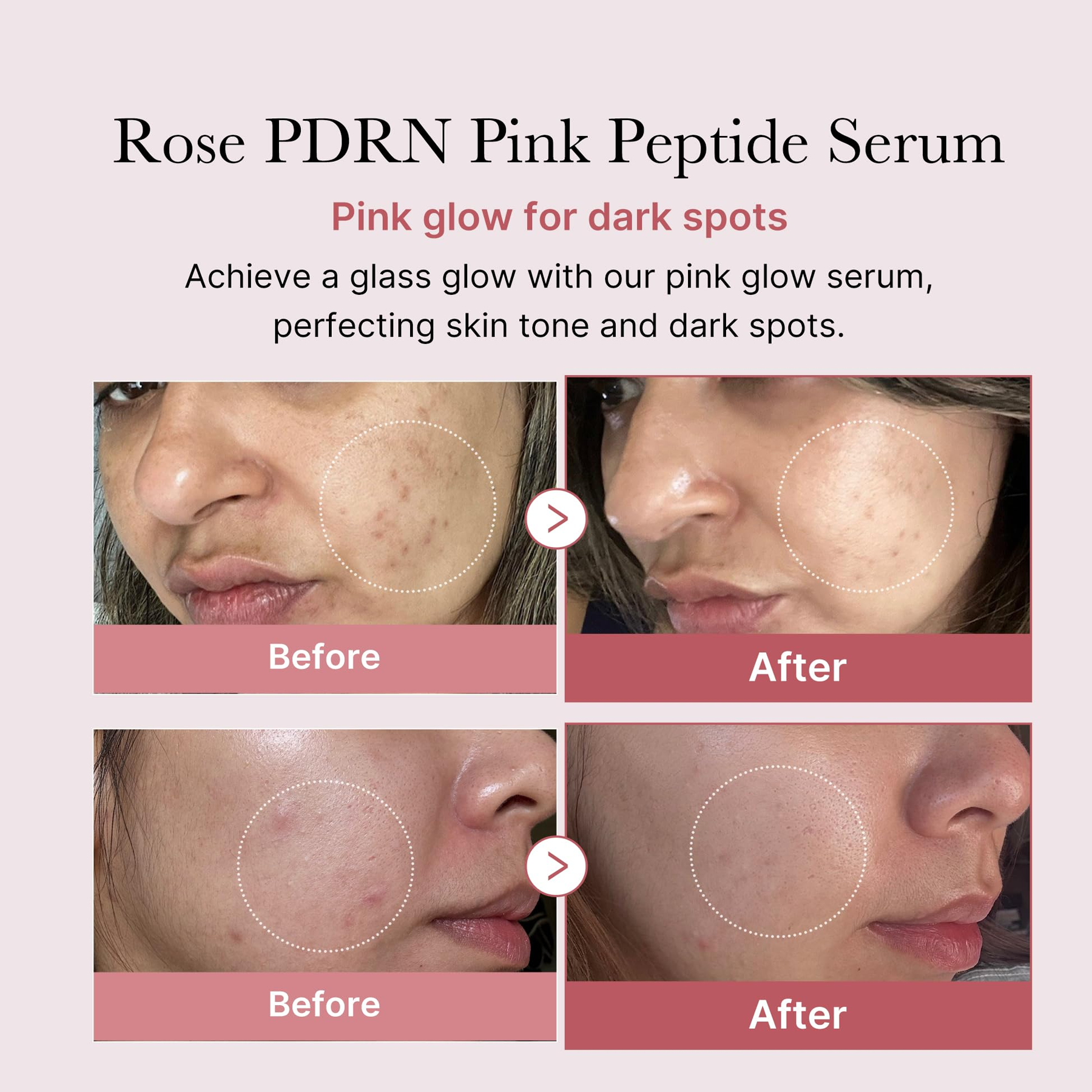 After and after usage of Medicube PDRN Pink Peptide Serum