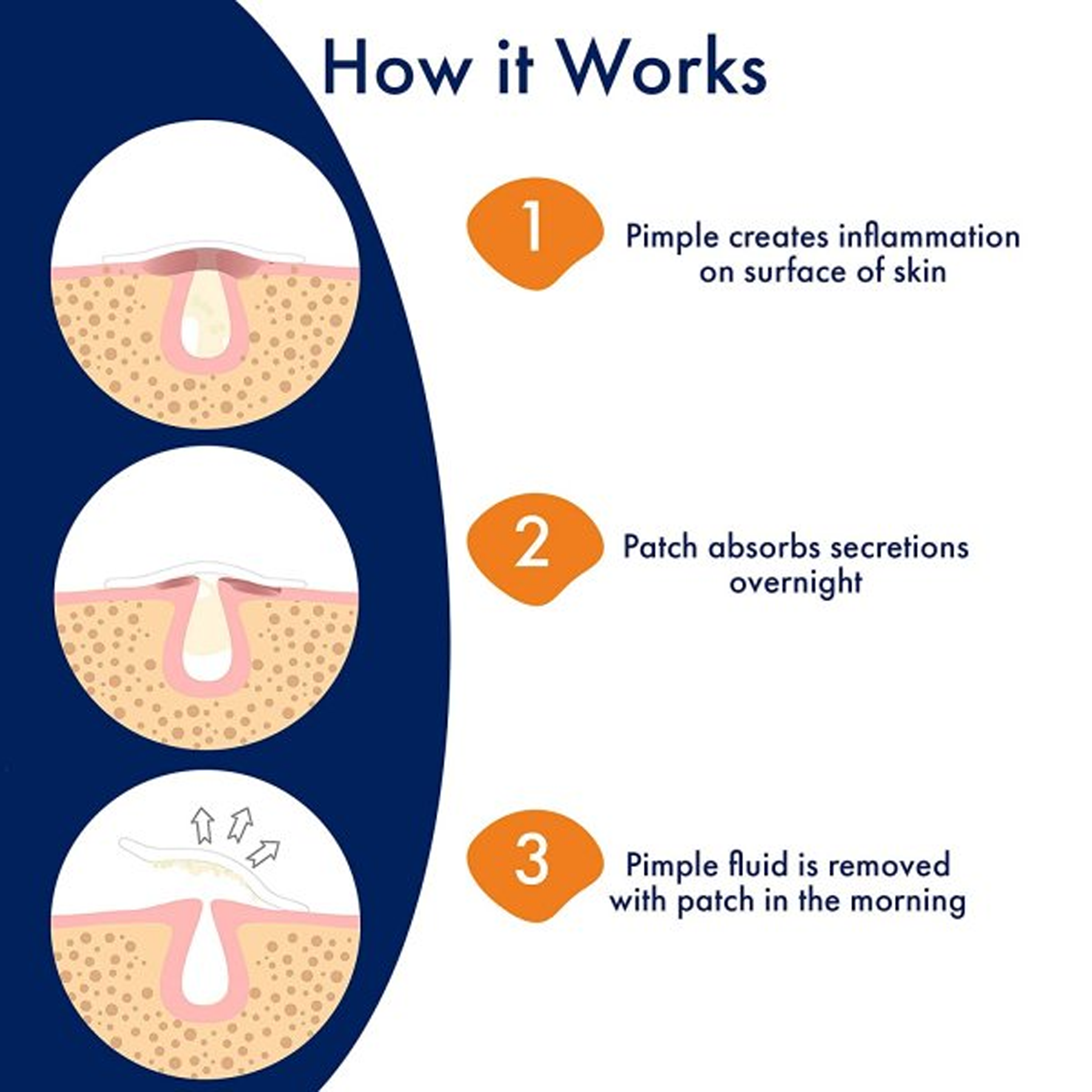 PanOxyl Overnight Spot Patches 40 Clear Patches - Acne Patches: Hydrocolloid patches 