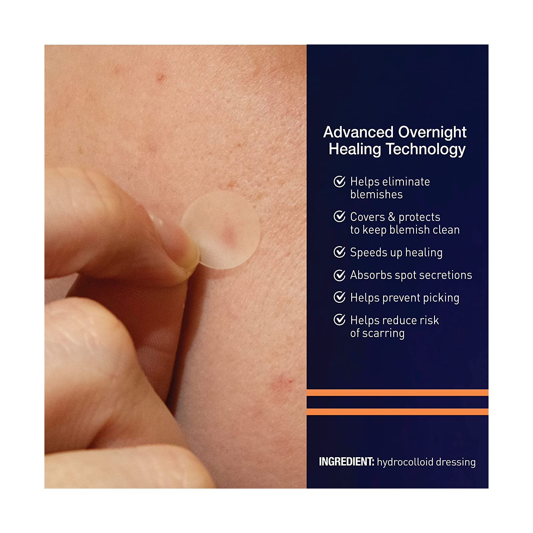 PanOxyl Overnight Spot Patches 40 Clear Patches - Acne Patches: Hydrocolloid patches 