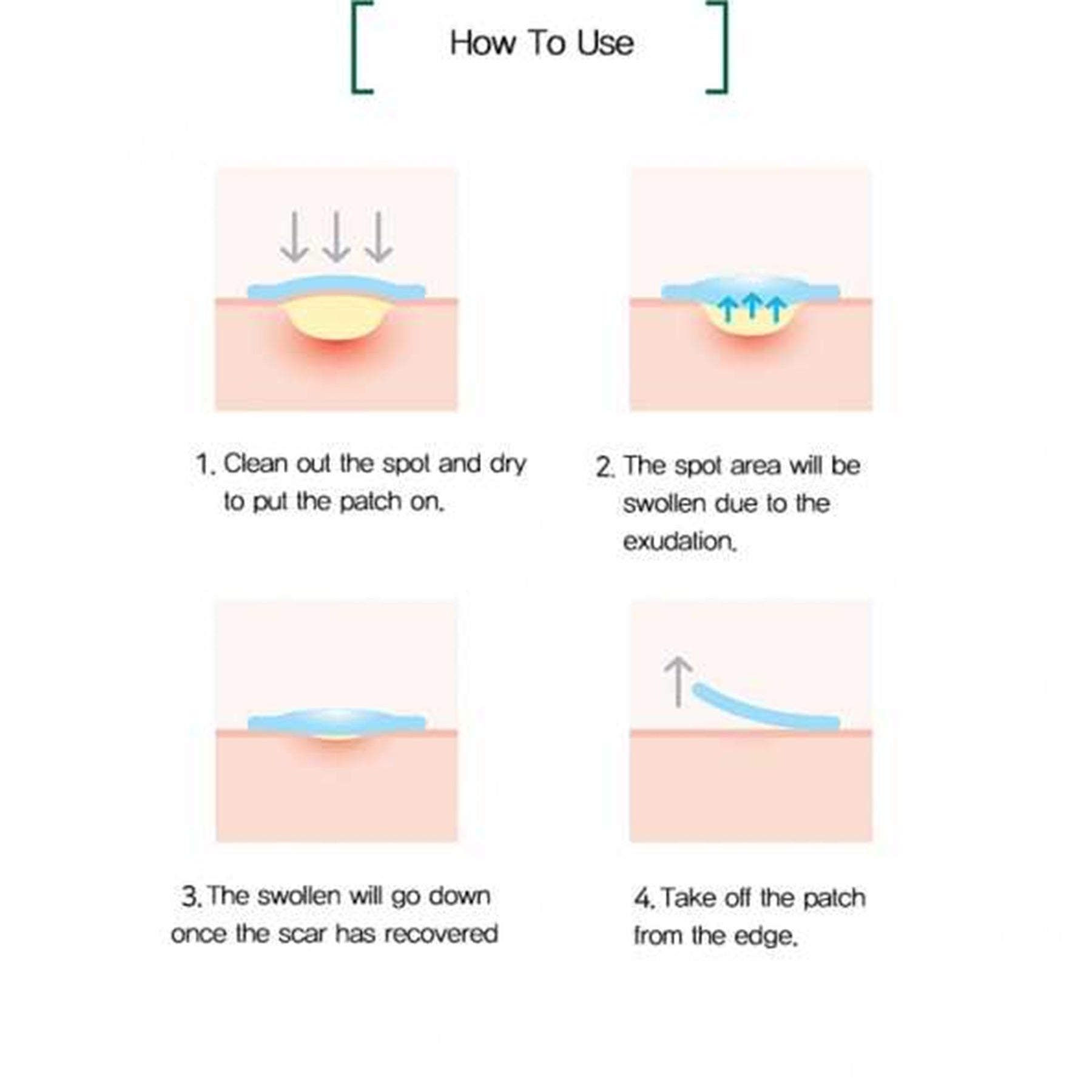 Some By Mi - Clear Spot Patch - how to use