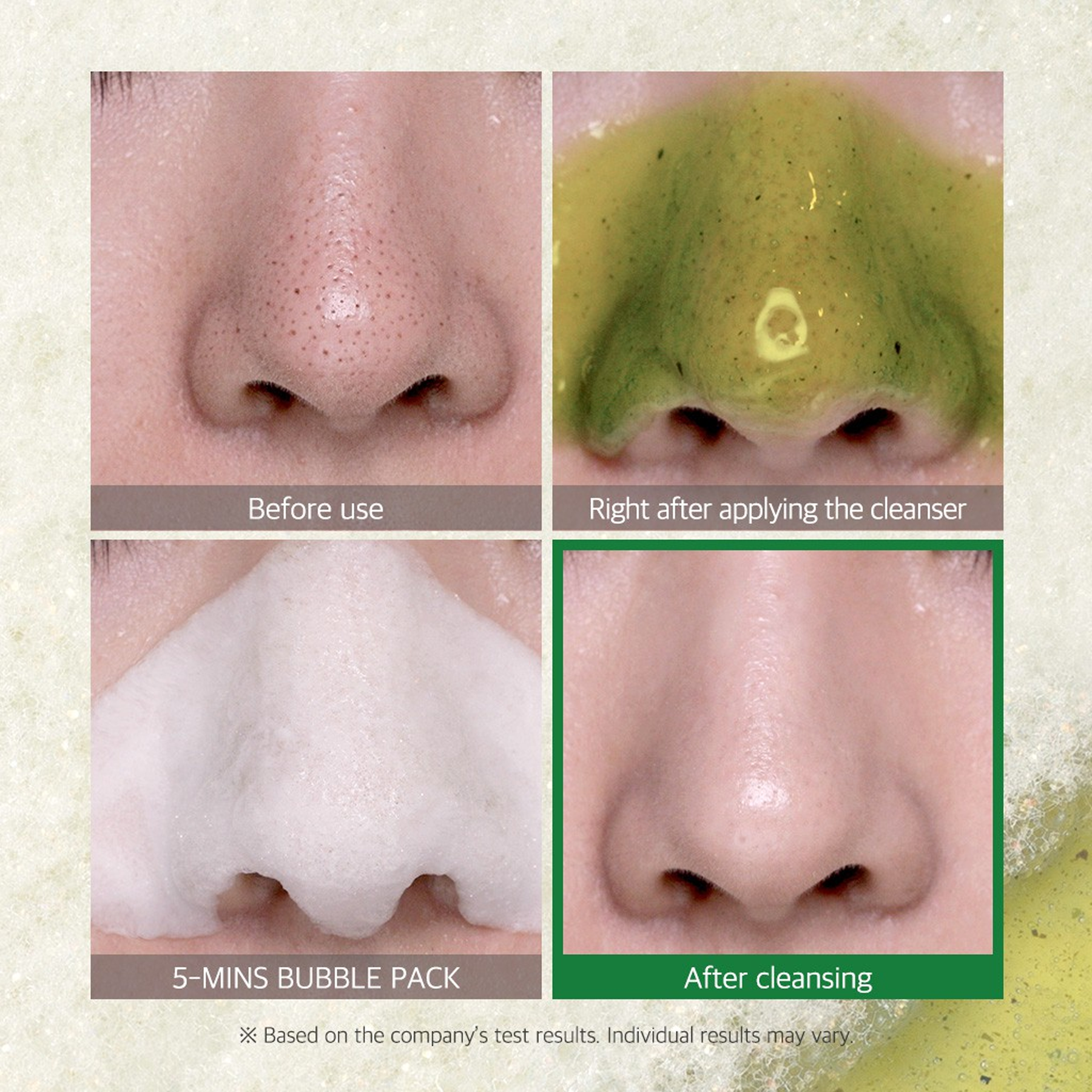 Some By Mi – Bye Bye Blackhead 30 Days Miracle Green Tea Tox Bubble Cleanser- perfect for all skin types