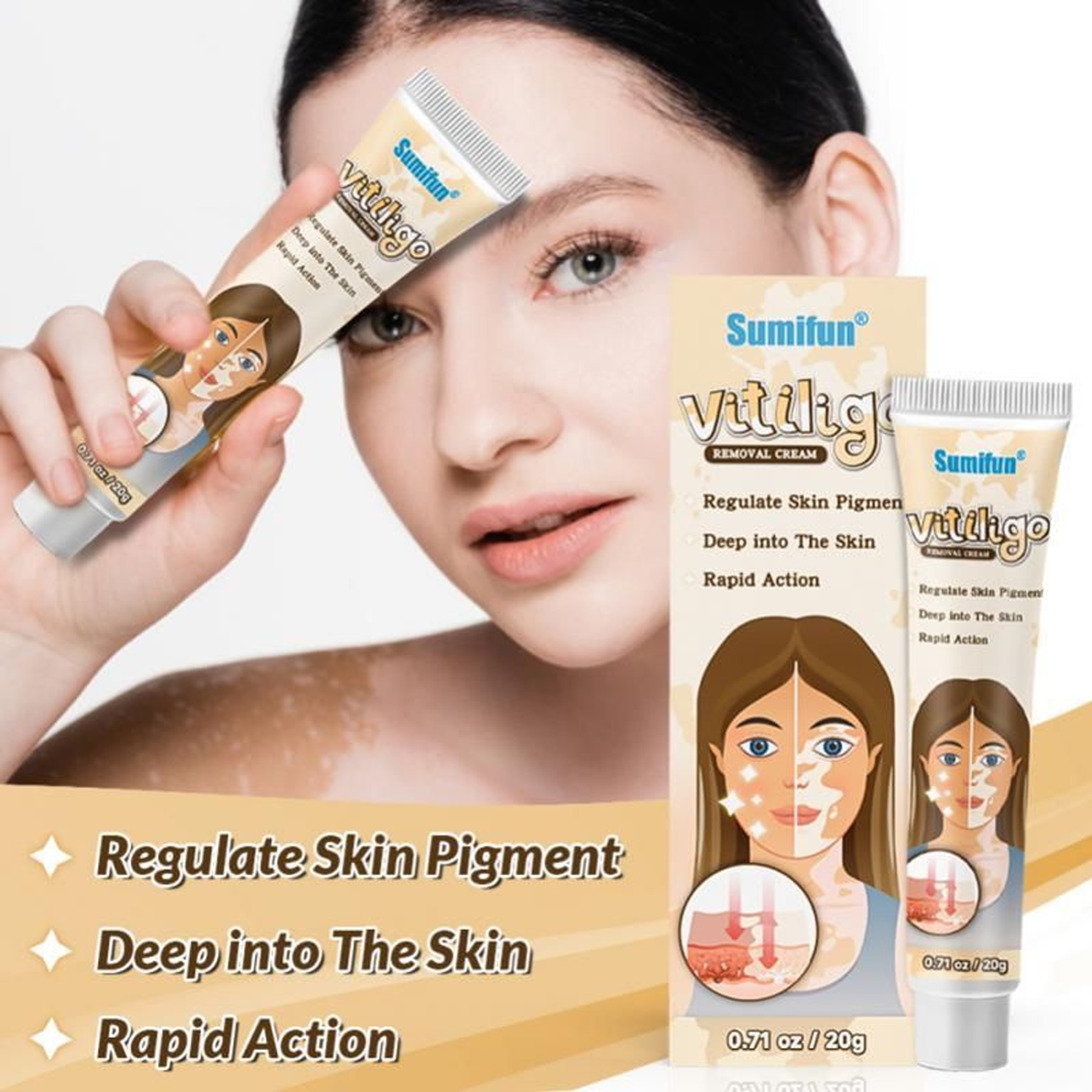 The Key Benefits of Sumifun Vitiligo Removal Cream