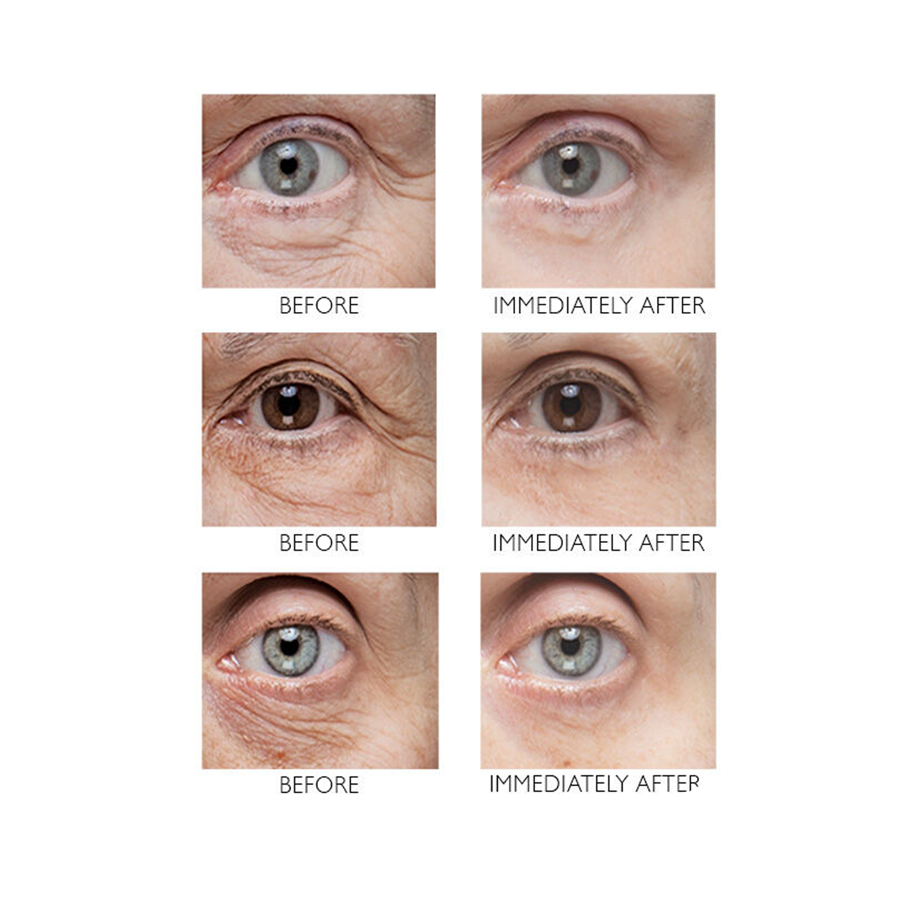 Peter Thomas Roth Instant FIRMx Eye Cream - 30ml