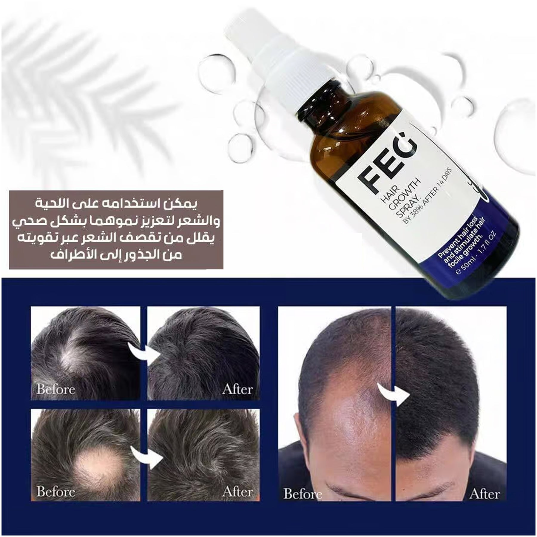 FEG Hair Growth Spray - 50ml